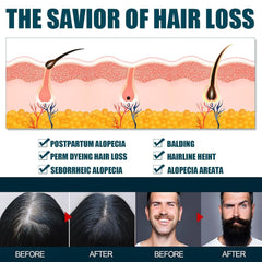 Miioto Hair Growth Serum, 180 ML Produs de creștere a părului pentru bărbați, ser de păr pentru creșterea părului, îngrijirea scalpului Promovează părul mai gros Hrănește scalpul și previne căderea părului Ingrijirea parului Naty Shop