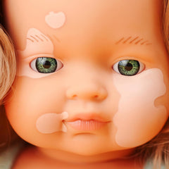 Miniland: Kaukasische dunkelblonde Babypuppe mit Vitiligo, 38cm, handgefertigt in Spanien aus weichem Vinyl Puppen.