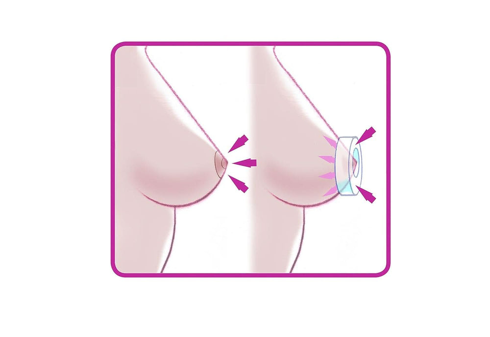 ELANEE Brust-Ringe, Schutz Der Brustwarze Bh-Kontakt Durch Hohllagerung, Ideal Bei Wunden, Entzündeten Brustwarzen Durch Stillen, 10 Stück (222-00) Accesorii Hrana si Alaptare Bebe Naty Shop